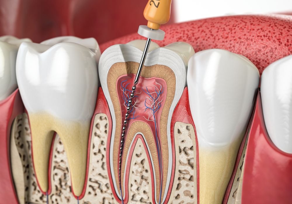 xr:d:DAGAnzp8slg:27,j:2648539581341429508,t:24032715